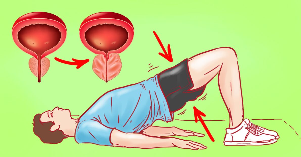 Exercice pour la prostatite: gymnastique pour l'inflammation de la ...